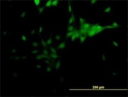 TLX/NR2E1 Antibody (4D2), Novus Biologicals 0.1 mg | Buy Online | Novus Biologicals | Fisher Scientific