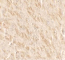 TLX2 Antibody - BSA Free, Novus Biologicals 0.1 mg; Unconjugated:Antibodies,