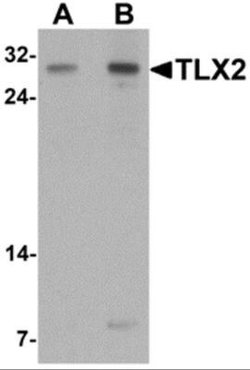 TLX2 Antibody - BSA Free, Novus Biologicals 0.1 mg; Unconjugated:Antibodies,