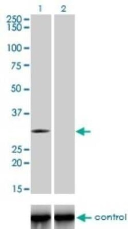 TLX3 Antibody (2A3), Novus Biologicals 0.1 mg | Buy Online | Novus Biologicals | Fisher Scientific