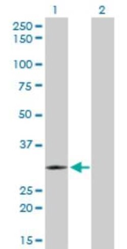 TLX3 Antibody (2A3), Novus Biologicals 0.1 mg | Buy Online | Novus Biologicals | Fisher Scientific