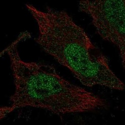 TLX3 Antibody, Novus Biologicals:Antibodies:Primary Antibodies