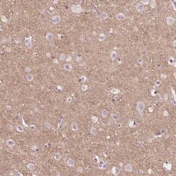 TM6SF2 Antibody, Novus Biologicals 0.1 mL | Buy Online | Novus Biologicals | Fisher Scientific