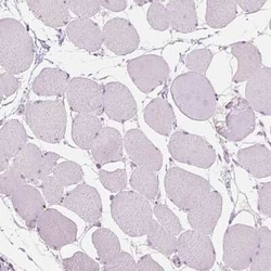 TM6SF2 Antibody, Novus Biologicals 0.1 mL | Buy Online | Novus Biologicals | Fisher Scientific