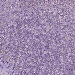 TM6SF2 Antibody, Novus Biologicals 0.1 mL | Buy Online | Novus Biologicals | Fisher Scientific