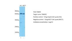 TM6SF2 Rabbit anti-Human, Polyclonal, Novus Biologicals 0.1ml; Unconjugated:Antibodies