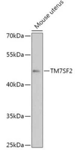 TM7SF2 Antibody - Azide and BSA Free, Novus Biologicals 0.02 mL | Buy Online | Novus Biologicals | Fisher Scientific