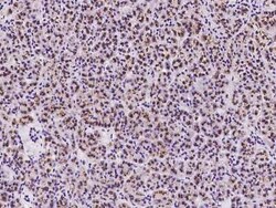 TM9SF2 Antibody, Novus Biologicals 50 &mu;g, Unconjugated:Antibodies, Polyclonal