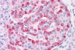 TM9SF4 Antibody, Novus Biologicals 50 &mu;g; Unconjugated:Antibodies, Polyclonal