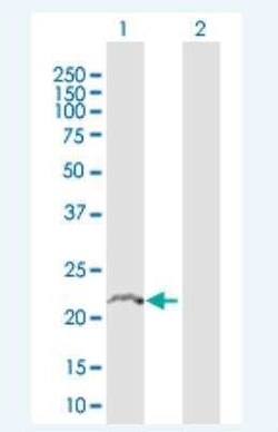 TMBIM4 Antibody, Novus Biologicals 50 &mu;g | Buy Online | Novus Biologicals | Fisher Scientific