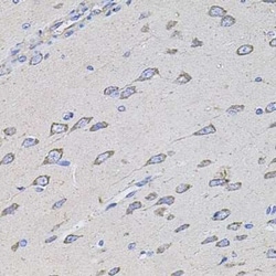TMC1 Antibody - BSA Free, Novus Biologicals:Antibodies:Primary Antibodies