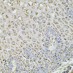 TMC1 Antibody - BSA Free, Novus Biologicals:Antibodies:Primary Antibodies