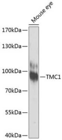 TMC1 Antibody - BSA Free, Novus Biologicals:Antibodies:Primary Antibodies