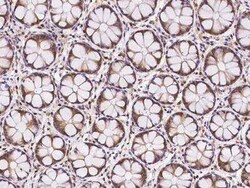 TMC2 Antibody, Novus Biologicals 100 &mu;g; Unconjugated:Antibodies