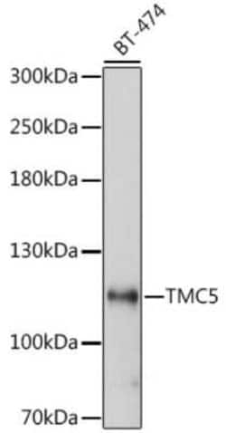 TMC5 Antibody - Azide and BSA Free, Novus Biologicals 0.1 mL; Unconjugated:Antibodies,