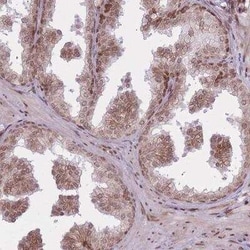 TMC6 Antibody, Novus Biologicals 25 &mu;L | Buy Online | Novus Biologicals | Fisher Scientific