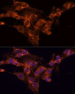 TMED2 Antibody - Azide and BSA Free, Novus Biologicals:Antibodies:Primary