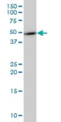 TMEFF2/Tomoregulin-2 Antibody (1D12), Novus Biologicals 0.1 mg | Buy Online | Novus Biologicals | Fisher Scientific