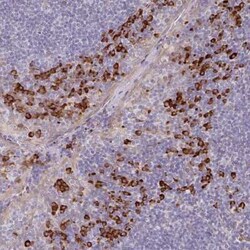 TMEM1 Antibody, Novus Biologicals 0.1 mL, Unconjugated:Antibodies, Polyclonal