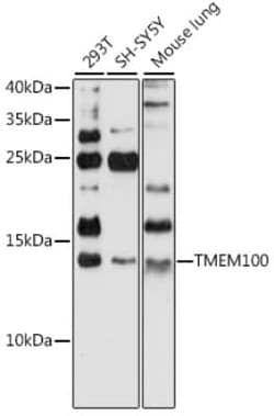TMEM100 Antibody - Azide and BSA Free, Novus Biologicals 0.1 mL; Unconjugated:Antibodies,