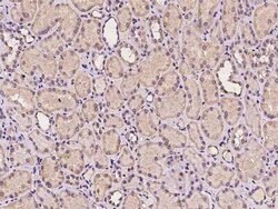 TMEM106C Antibody, Novus Biologicals 50 &mu;g | Buy Online | Novus Biologicals | Fisher Scientific