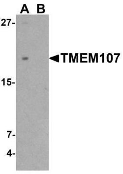 TMEM107 Antibody - BSA Free, Novus Biologicals 0.1 mg | Buy Online | Novus Biologicals | Fisher Scientific