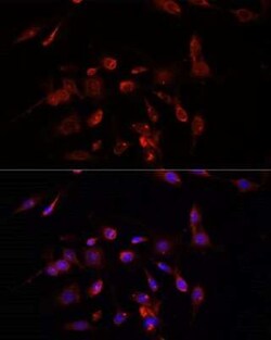 TMEM11 Antibody - Azide and BSA Free, Novus Biologicals:Antibodies:Primary