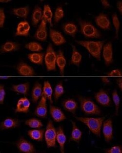 TMEM11 Antibody - Azide and BSA Free, Novus Biologicals:Antibodies:Primary