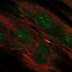 TMEM117 Antibody, Novus Biologicals 25 &mu;L | Buy Online | Novus Biologicals | Fisher Scientific