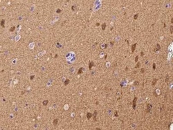 TMEM132A Antibody, Novus Biologicals 100 &mu;g, Unconjugated:Antibodies,