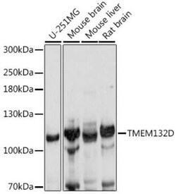 TMEM132D Antibody - Azide and BSA Free, Novus Biologicals 0.1 mL | Buy Online | Novus Biologicals | Fisher Scientific