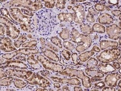 TMEM143 Antibody, Novus Biologicals 100 &mu;g | Buy Online | Novus Biologicals | Fisher Scientific