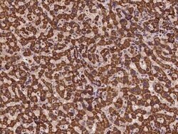 TMEM143 Antibody, Novus Biologicals 100 &mu;g | Buy Online | Novus Biologicals | Fisher Scientific