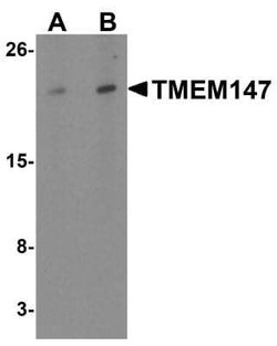 TMEM147 Antibody - BSA Free, Novus Biologicals 0.1 mg | Buy Online | Novus Biologicals | Fisher Scientific
