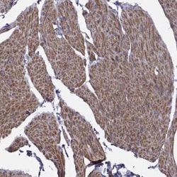 TMEM158 Antibody, Novus Biologicals:Antibodies:Primary Antibodies