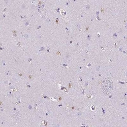 TMEM169 Antibody, Novus Biologicals:Antibodies:Primary Antibodies