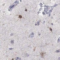 TMEM169 Rabbit anti-Human, Polyclonal, Novus Biologicals:Antibodies:Primary