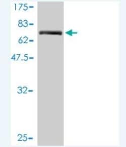 TMEM16K Antibody (2B12-1A11), Novus Biologicals 0.1 mg, Unconjugated:Antibodies,