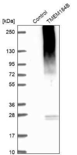 TMEM184B Antibody, Novus Biologicals 0.1 mL; Unconjugated:Antibodies, Polyclonal