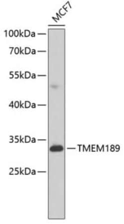 TMEM189 Antibody - BSA Free, Novus Biologicals 0.1 mL; Unconjugated:Antibodies,