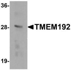 TMEM192 Antibody - BSA Free, Novus Biologicals 0.1 mg; Unconjugated:Antibodies,