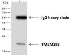 TMEM199 Antibody, Novus Biologicals:Antibodies:Primary Antibodies