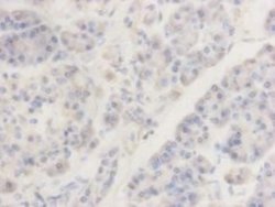 TMEM200A Mouse anti-Human, Clone: 4-B3, Novus Biologicals 100&mu;L:Antibodies,