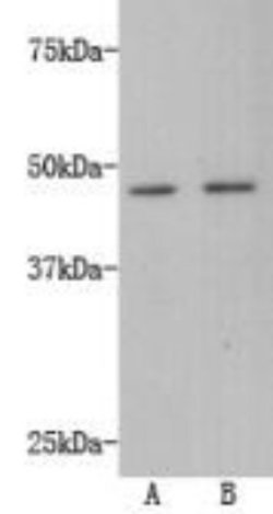 TMEM200A Mouse anti-Human, Clone: 4-B3, Novus Biologicals 100&mu;L:Antibodies,