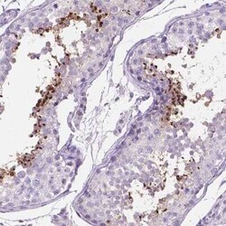 TMEM210 Antibody, Novus Biologicals 25 &mu;L, Unconjugated:Antibodies,