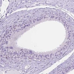 TMEM210 Antibody, Novus Biologicals 25 &mu;L, Unconjugated:Antibodies,