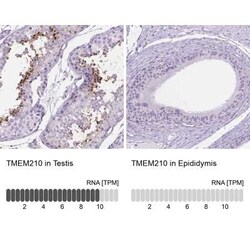 TMEM210 Antibody, Novus Biologicals 25 &mu;L, Unconjugated:Antibodies,