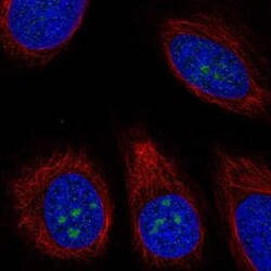 TMEM217 Antibody, Novus Biologicals 25ul; Unconjugated:Antibodies, Polyclonal