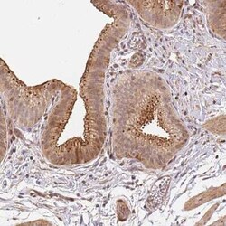 TMEM222 Antibody, Novus Biologicals:Antibodies:Primary Antibodies