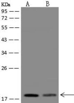 TMEM230 Antibody, Novus Biologicals 100 &mu;g; Unconjugated:Antibodies,